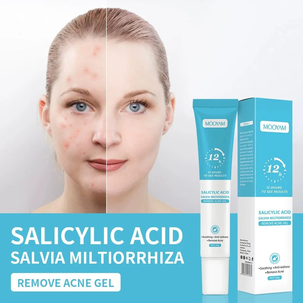 Gel Antiacnee cu Acid Salicilic